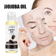 OUHOE Jojoba Oil for Hydrated Skin and Hair Care