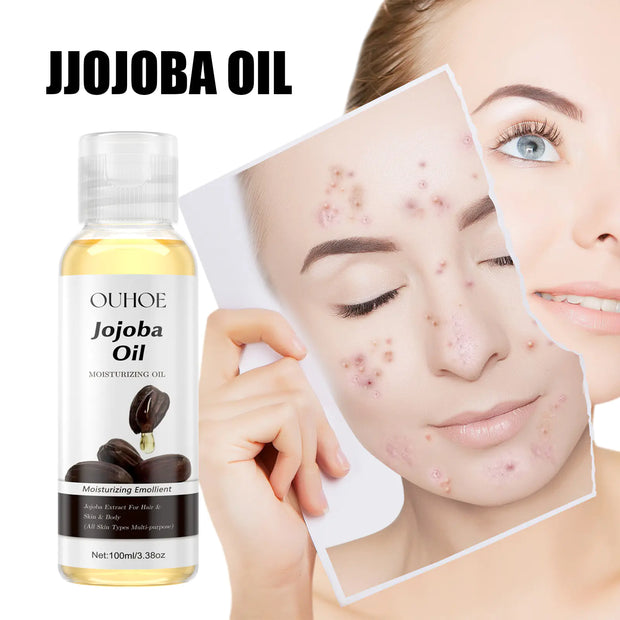 OUHOE Jojoba Oil for Hydrated Skin and Hair Care